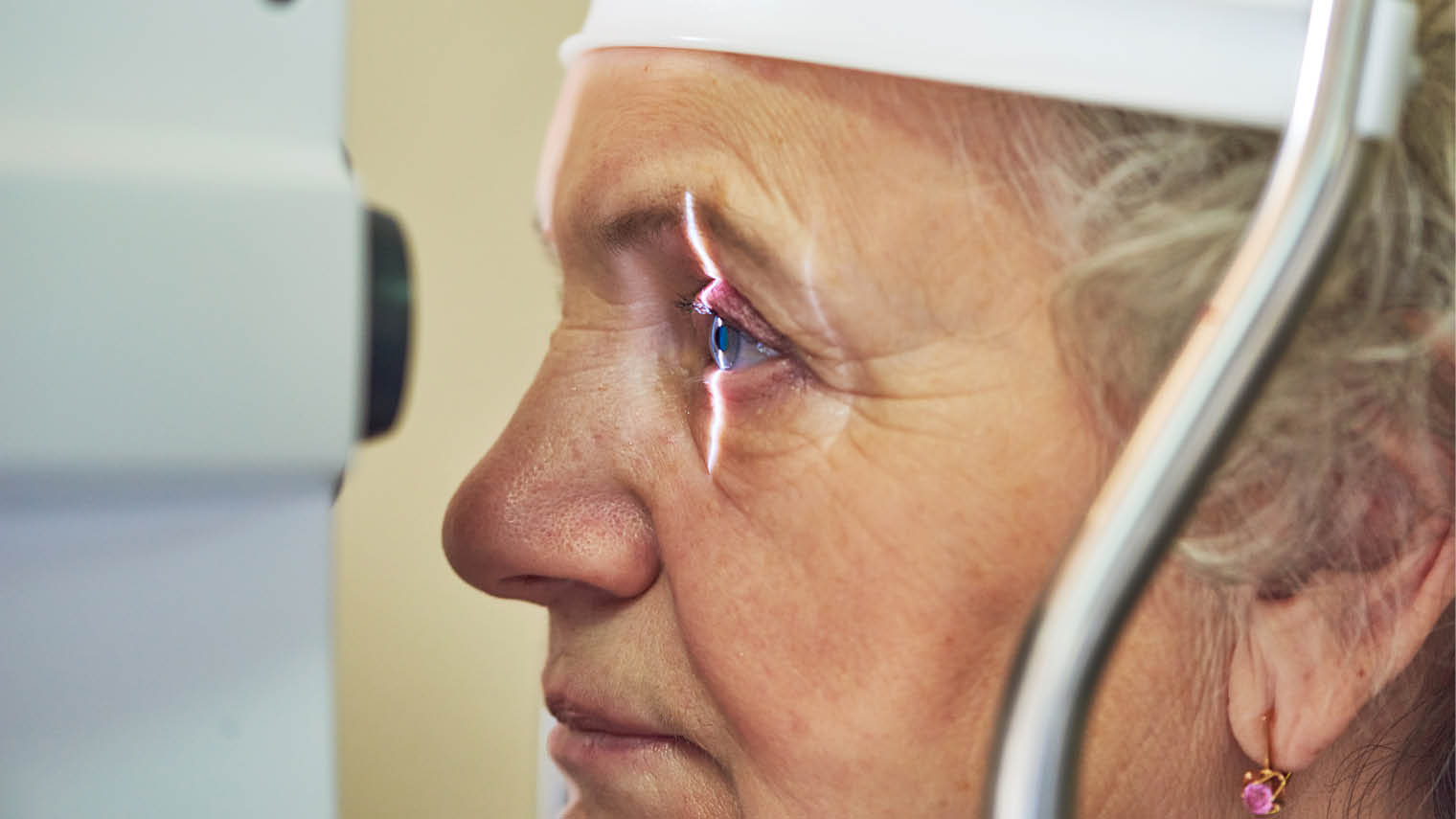 age-related-macular-degeneration-what-it-is-and-how-to-avoid